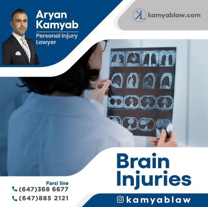 Brain and Spinal Cord Injury