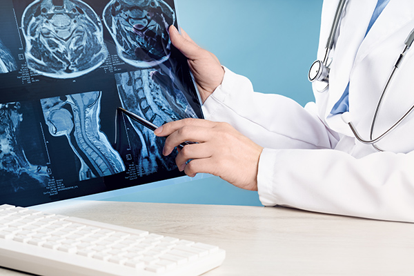 Brain and Spinal Cord Injury